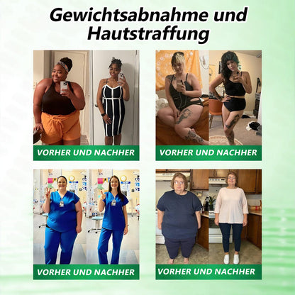 ✅Geelemon® 🎁Nur noch 5 Boxen übrig! Jetzt zusätzlich 30 % Rabatt!Bleiben Sie fit und gesund.