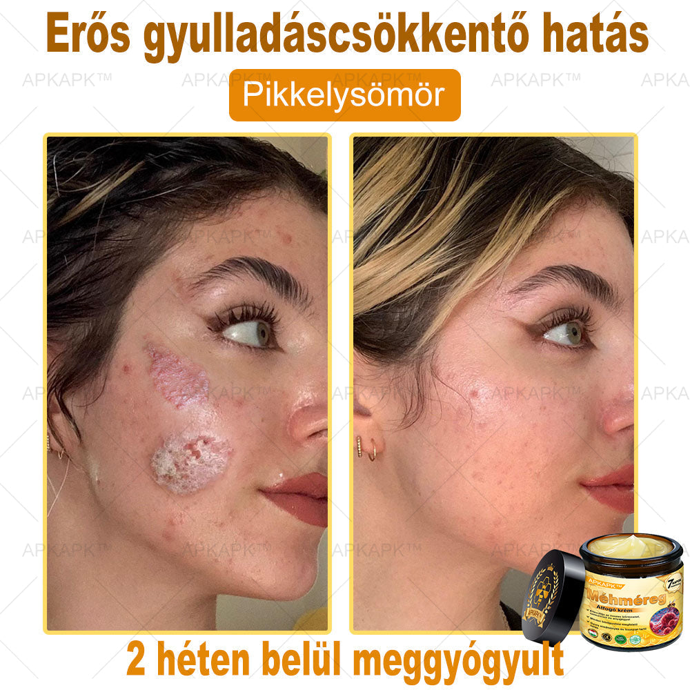APKAPK® Méhméreges Bőrregeneráló & Feszesítő Krém– Prémium Anti-Aging Ápolás Érett és Érzékeny Bőrre