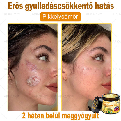 APKAPK® Méhméreges Bőrregeneráló & Feszesítő Krém– Prémium Anti-Aging Ápolás Érett és Érzékeny Bőrre
