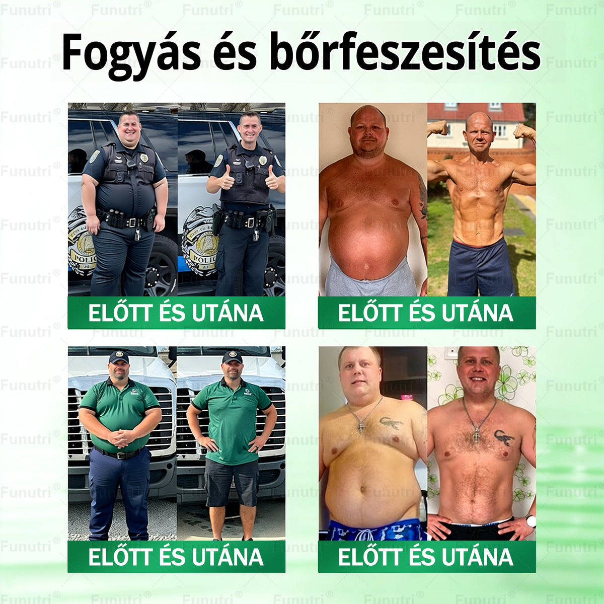 Magyar szakértők által ajánlott 💖Funutri® 10 az 1-ben anyagcsere-támogató karcsúsító nano mikro-tűs tapasz