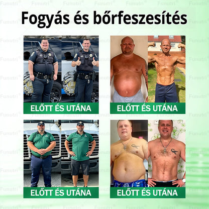 Magyar szakértők által ajánlott 💖Funutri® 10 az 1-ben anyagcsere-támogató karcsúsító nano mikro-tűs tapasz