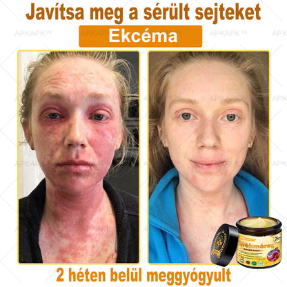 APKAPK® Méhméreges Bőrregeneráló & Feszesítő Krém– Prémium Anti-Aging Ápolás Érett és Érzékeny Bőrre