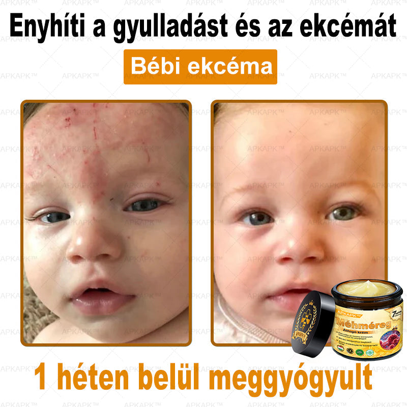 APKAPK® Méhméreges Bőrregeneráló & Feszesítő Krém– Prémium Anti-Aging Ápolás Érett és Érzékeny Bőrre