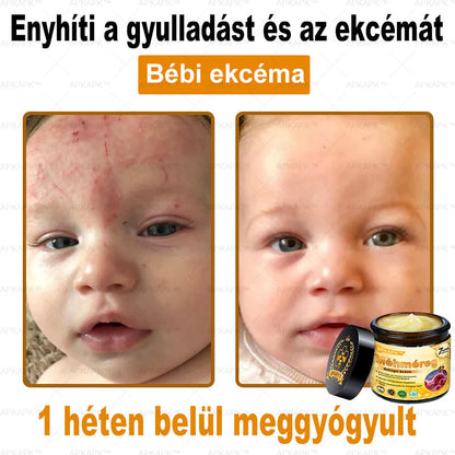 APKAPK® Méhméreges Bőrregeneráló & Feszesítő Krém– Prémium Anti-Aging Ápolás Érett és Érzékeny Bőrre