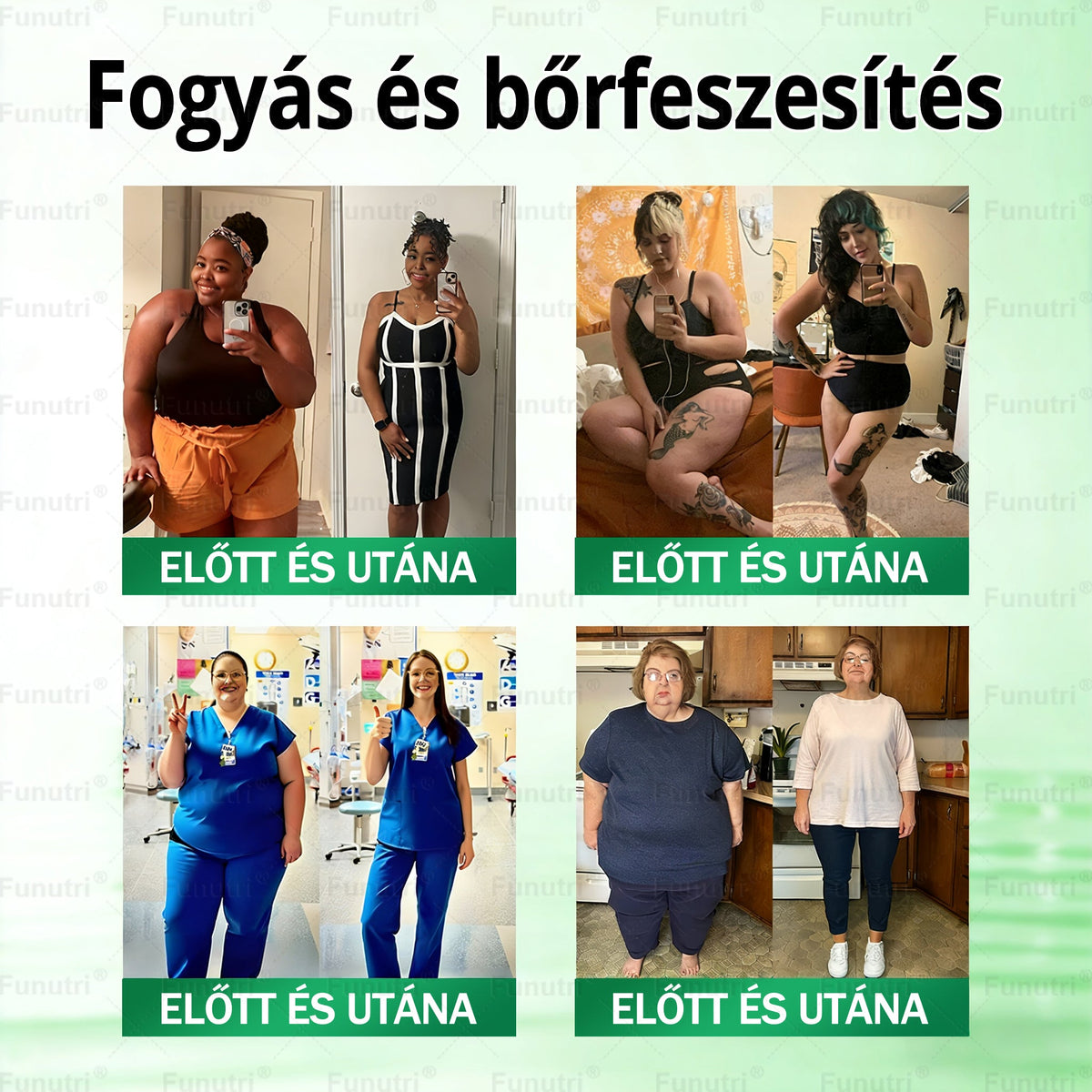 Magyar szakértők által ajánlott 💖Funutri® 10 az 1-ben anyagcsere-támogató karcsúsító nano mikro-tűs tapasz