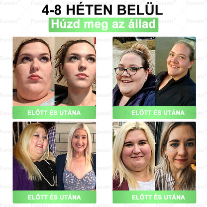 Magyar szakértők által ajánlott 💖Funutri® 10 az 1-ben anyagcsere-támogató karcsúsító nano mikro-tűs tapasz