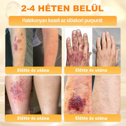 APKAPK® Méhméreges Bőrregeneráló & Feszesítő Krém– Prémium Anti-Aging Ápolás Érett és Érzékeny Bőrre