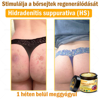 APKAPK® Méhméreges Bőrregeneráló & Feszesítő Krém– Prémium Anti-Aging Ápolás Érett és Érzékeny Bőrre