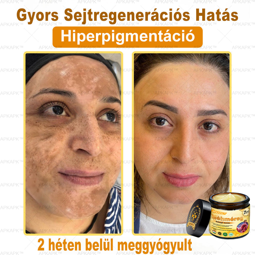 APKAPK® Méhméreges Bőrregeneráló & Feszesítő Krém– Prémium Anti-Aging Ápolás Érett és Érzékeny Bőrre