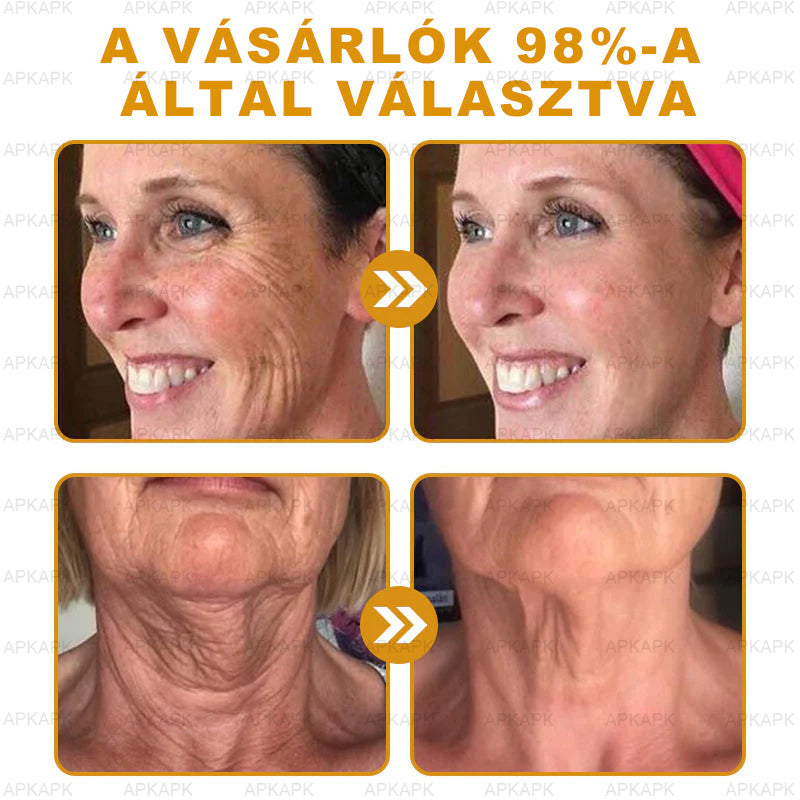 APKAPK® Méhméreges Bőrregeneráló & Feszesítő Krém– Prémium Anti-Aging Ápolás Érett és Érzékeny Bőrre