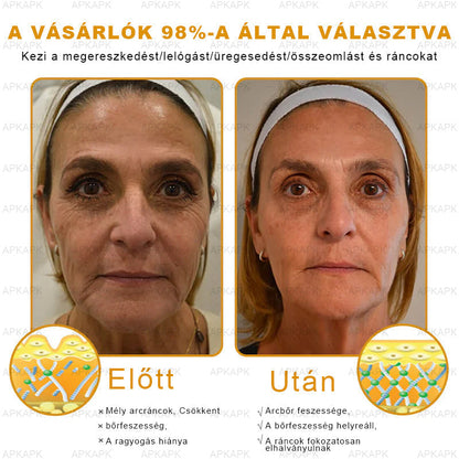 APKAPK® Méhméreges Bőrregeneráló & Feszesítő Krém– Prémium Anti-Aging Ápolás Érett és Érzékeny Bőrre